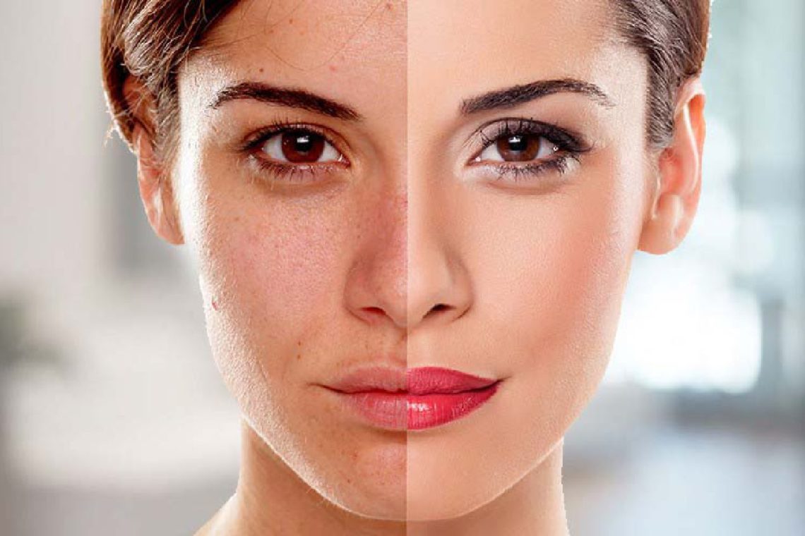 Skin and Laser Treatments